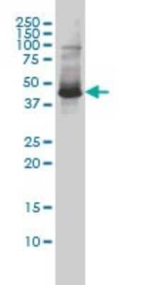 Western Blot: ZNF174 Antibody (2D7-E9) [H00007727-M01]