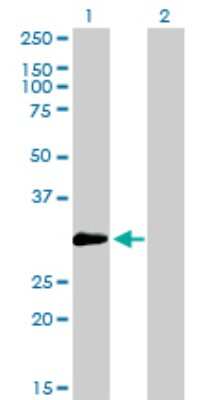 Western Blot: ZNF174 Antibody (2D7-E9) [H00007727-M01]