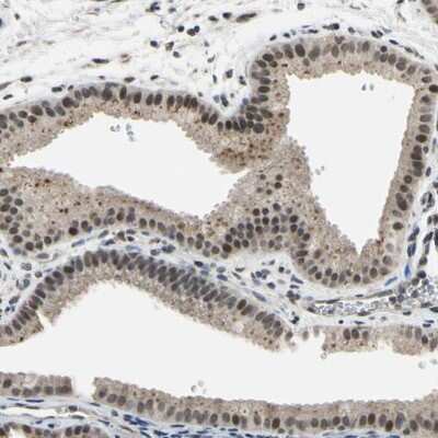 Immunohistochemistry-Paraffin: ZNF174 Antibody [NBP1-86821]