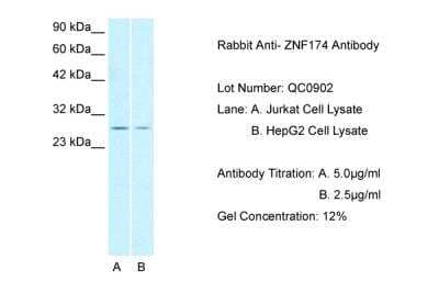 Western Blot: ZNF174 Antibody [NBP2-86443]