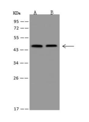 Western Blot: ZNF174 Antibody [NBP3-05993]