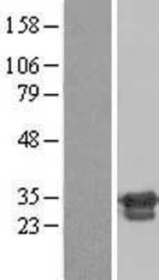 Western Blot: ZNF174 Overexpression Lysate [NBL1-18069]