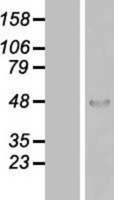 Western Blot: ZNF174 Overexpression Lysate [NBP2-08008]