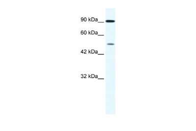 Western Blot: ZNF175 Antibody [NBP2-86444]