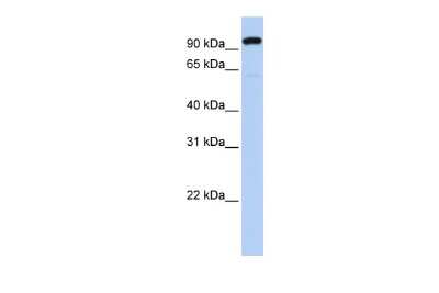 Western Blot: ZNF175 Antibody [NBP2-86445]