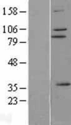 Western Blot: ZNF175 Overexpression Lysate [NBP2-07522]