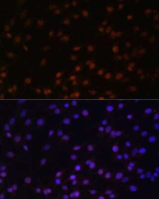 Immunocytochemistry/ Immunofluorescence: ZNF177 Antibody - Azide and BSA Free [NBP3-05074]