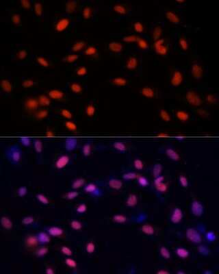Immunocytochemistry/ Immunofluorescence: ZNF177 Antibody - Azide and BSA Free [NBP3-05074]