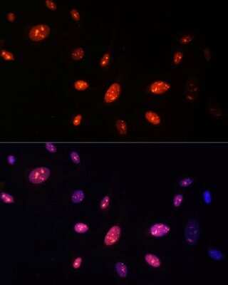 Immunocytochemistry/ Immunofluorescence: ZNF177 Antibody - Azide and BSA Free [NBP3-05074]
