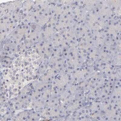 Immunohistochemistry-Paraffin: ZNF177 Antibody [NBP1-86523]