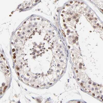 Immunohistochemistry-Paraffin: ZNF177 Antibody [NBP1-86523]
