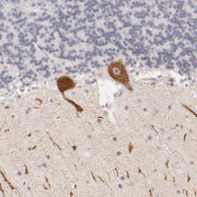 Immunohistochemistry-Paraffin: ZNF177 Antibody [NBP1-86523]