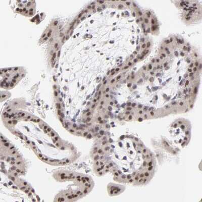 Immunohistochemistry-Paraffin: ZNF177 Antibody [NBP1-86523]
