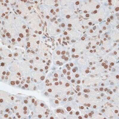 Immunohistochemistry-Paraffin: ZNF177 Antibody - Azide and BSA Free [NBP3-05074]