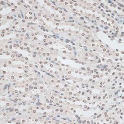 Immunohistochemistry-Paraffin: ZNF177 Antibody - Azide and BSA Free [NBP3-05074]