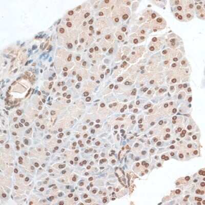 Immunohistochemistry-Paraffin: ZNF177 Antibody - Azide and BSA Free [NBP3-05074]