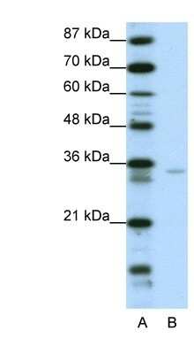 Western Blot: ZNF177 Antibody [NBP1-80299]