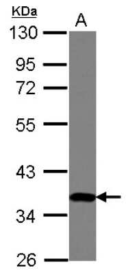 Western Blot: ZNF177 Antibody [NBP2-20965]