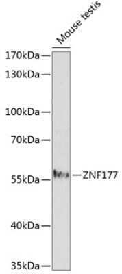 Western Blot: ZNF177 AntibodyAzide and BSA Free [NBP2-93871]