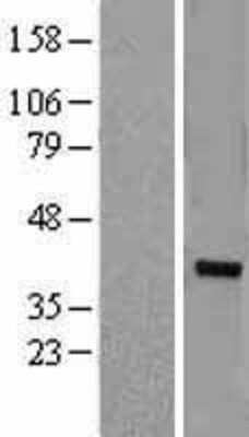 Western Blot: ZNF177 Overexpression Lysate [NBL1-18071]