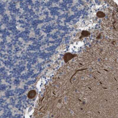 Immunohistochemistry-Paraffin: ZNF179 Antibody [NBP2-13236]