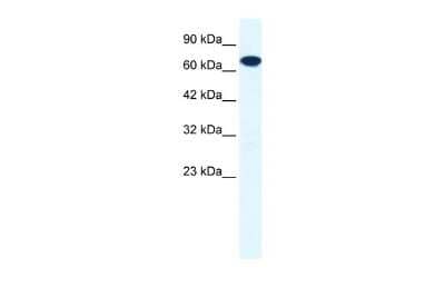 Western Blot: ZNF179 Antibody [NBP2-86448]