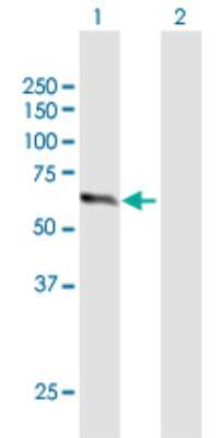 Western Blot: ZNF18 Antibody [H00007566-B01P]