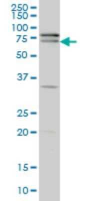 Western Blot: ZNF181 Antibody (5F1) [H00339318-M01]