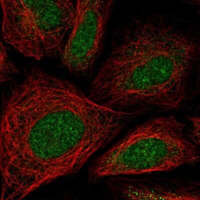 Immunocytochemistry/ Immunofluorescence: ZNF181 Antibody [NBP2-56556]