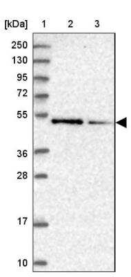 Western Blot: ZNF181 Antibody [NBP1-92618]