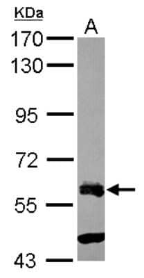 Western Blot: ZNF181 Antibody [NBP2-20967]