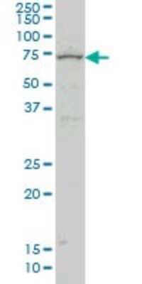 Western Blot: ZNF182 Antibody (6D11) [H00007569-M03]