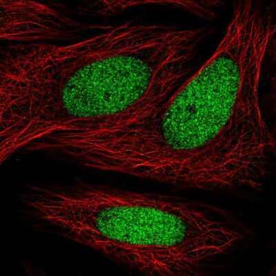 Immunocytochemistry/ Immunofluorescence: ZNF182 Antibody [NBP2-32480]