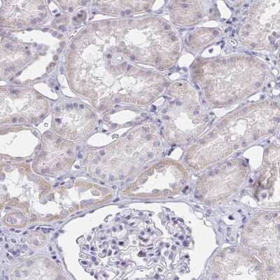 Immunohistochemistry-Paraffin: ZNF182 Antibody [NBP2-32480]