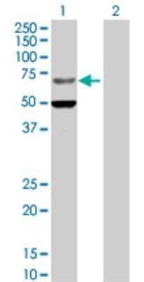 Western Blot: ZNF182 Antibody [H00007569-D01P]