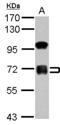 Western Blot: ZNF182 Antibody [NBP2-20968]