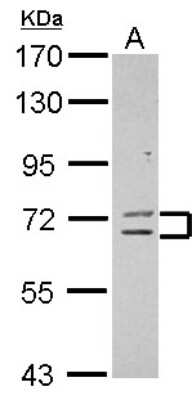 Western Blot: ZNF182 Antibody [NBP2-20969]