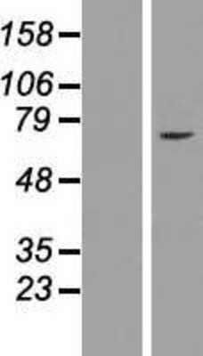 Western Blot: ZNF182 Overexpression Lysate [NBL1-18074]