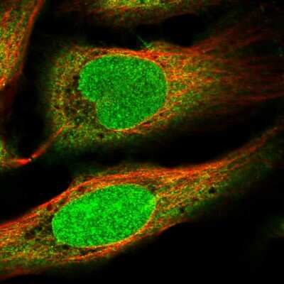 Immunocytochemistry/ Immunofluorescence: ZNF184 Antibody [NBP1-86159]