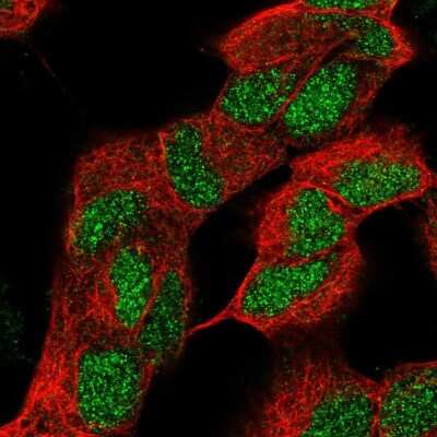 Immunocytochemistry/ Immunofluorescence: ZNF184 Antibody [NBP2-68823]