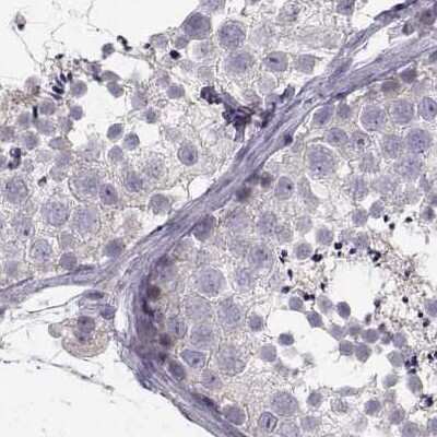 Immunohistochemistry-Paraffin: ZNF185 Antibody [NBP1-86192]