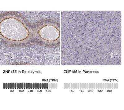 Immunohistochemistry-Paraffin: ZNF185 Antibody [NBP1-86452]