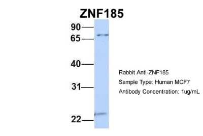 Western Blot: ZNF185 Antibody [NBP1-80320]