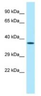 Western Blot: ZNF185 Antibody [NBP3-10319]