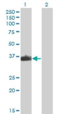 Western Blot: ZNF187 Antibody (3E11) [H00007741-M04]