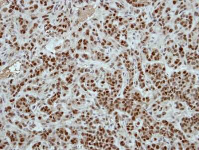 Immunohistochemistry-Paraffin: ZNF187 Antibody [NBP2-20970]