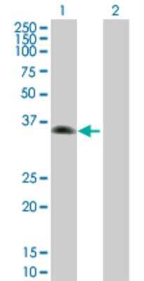 Western Blot: ZNF187 Antibody [H00007741-B01P]