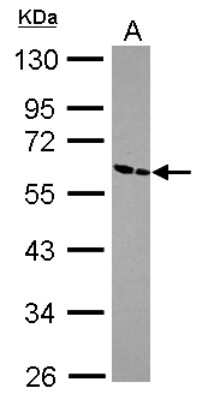 Western Blot: ZNF187 Antibody [NBP2-20970]