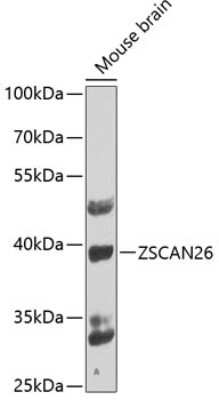 Western Blot: ZNF187 AntibodyBSA Free [NBP3-03215]