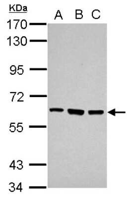 Western Blot: ZNF189 Antibody [NBP2-20971]